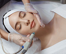 Спа-санаторий AMK Montis Club г. Железноводск. Процедура глубокого очищения HydraFacial и глубокого увлажнения Dermadrop.