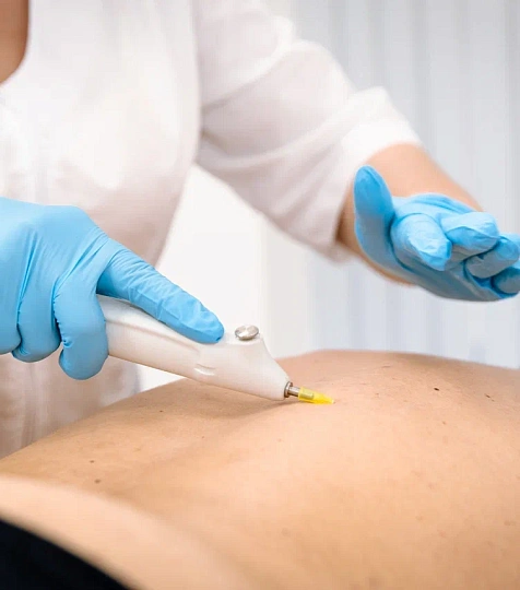  Cанаторий «Вернисаж» г. Кисловодск. Карбокситерапия