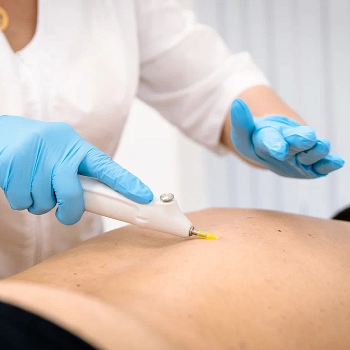  Cанаторий «Вернисаж» г. Кисловодск. Карбокситерапия